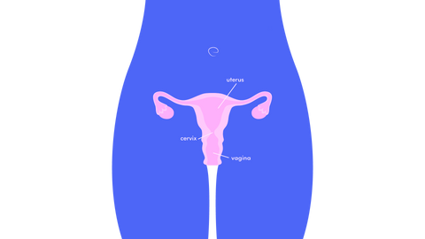 Can I Use a Menstrual Cup With a Tilted Uterus?