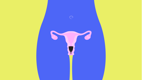 Can I Use a Menstrual Cup With a Tilted Uterus?